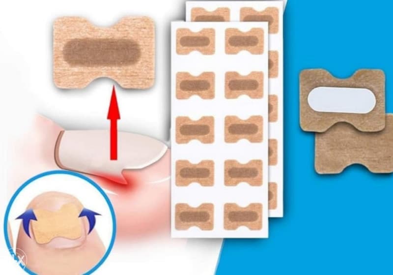 FLASTER PROTIV URASLIH NOKTIJU FLASTERI ZA URASLE NOKTE